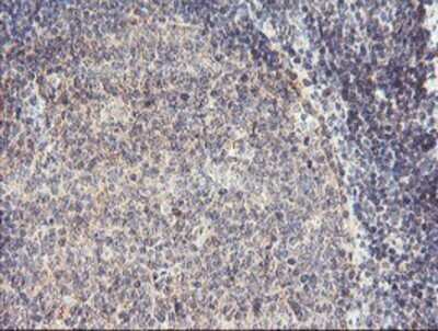 Immunohistochemistry: RFXANK Antibody (OTI3E7) - Azide and BSA Free [NBP2-73870]