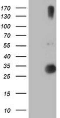 Western Blot: RFXANK Antibody (OTI3E7)Azide and BSA Free [NBP2-73870]