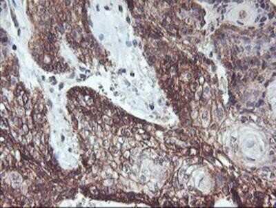 Immunohistochemistry-Paraffin: RFXANK Antibody (OTI3E7) [NBP2-01756]