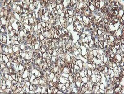 Immunohistochemistry-Paraffin: RFXANK Antibody (OTI3E7) [NBP2-01756]
