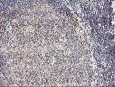 Immunohistochemistry-Paraffin: RFXANK Antibody (OTI3E7) [NBP2-01756]