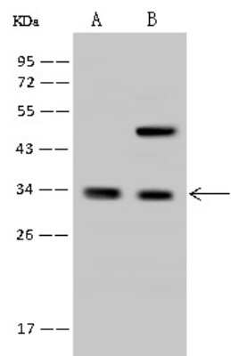 Western Blot: RFXANK Antibody [NBP2-97640]