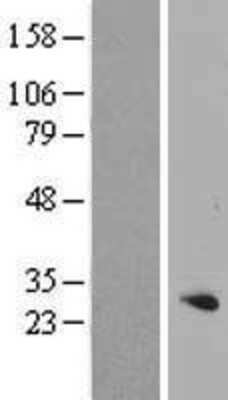 Western Blot: RFXANK Overexpression Lysate [NBP2-05684]