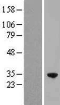 Western Blot: RFXANK Overexpression Lysate [NBP2-07963]