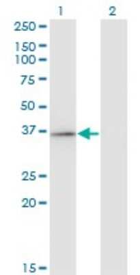 Western Blot: RFXAP Antibody (1B5) [H00005994-M01]