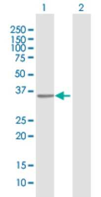 Western Blot: RFXAP Antibody [H00005994-B01P]