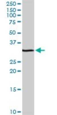 Western Blot: RFXAP Antibody [H00005994-D01P]