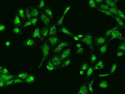 Immunocytochemistry/ Immunofluorescence: RG9MTD1 Antibody [NBP2-98053]