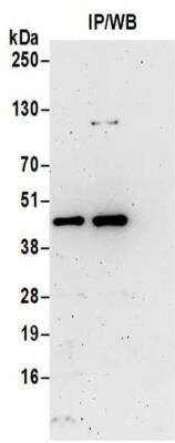 Immunoprecipitation: RG9MTD1 Antibody [NBP2-32078]