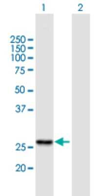 Western Blot: RG9MTD1 Antibody [H00054931-B01P]