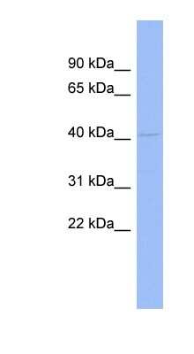 Western Blot: RG9MTD1 Antibody [NBP1-57362]