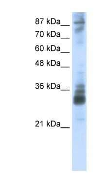 Western Blot: RG9MTD2 Antibody [NBP1-80478]