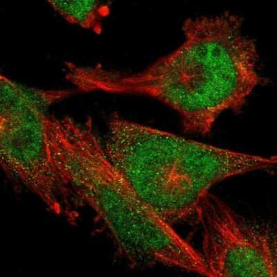 Immunocytochemistry/ Immunofluorescence: RG9MTD3 Antibody [NBP1-88770]