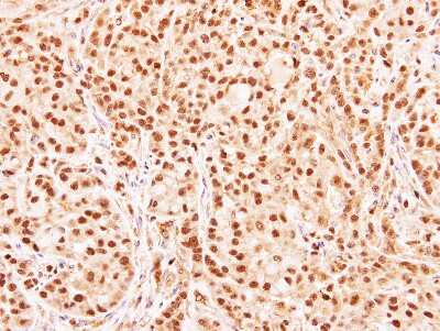 Immunohistochemistry-Paraffin: RG9MTD3 Antibody [NBP1-32516]