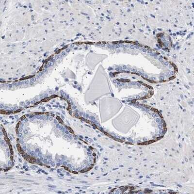 Immunohistochemistry-Paraffin: RG9MTD3 Antibody [NBP1-88770]