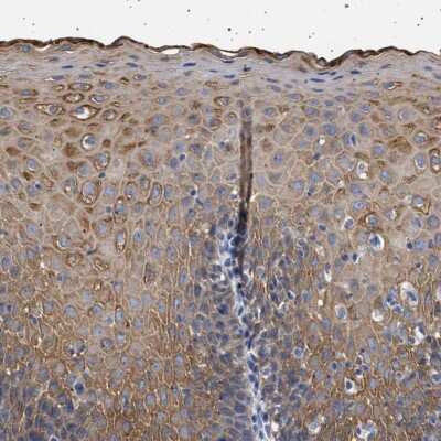 Immunohistochemistry-Paraffin: RG9MTD3 Antibody [NBP1-88770]