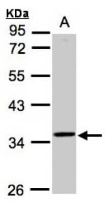 Western Blot: RG9MTD3 Antibody [NBP1-32516]