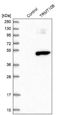 Western Blot: RG9MTD3 Antibody [NBP1-88770]