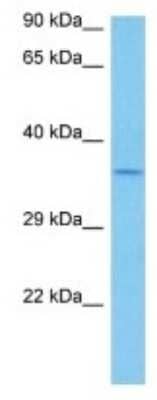 Western Blot: RG9MTD3 Antibody [NBP3-10214]