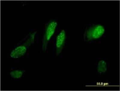 Immunocytochemistry/ Immunofluorescence: RGC32 Antibody (3B9) [H00028984-M01]