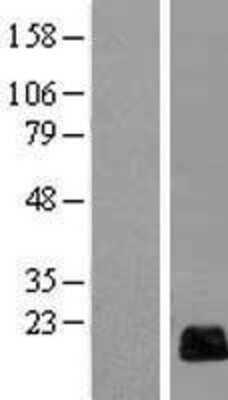 Western Blot: RGC32 Overexpression Lysate [NBL1-08157]