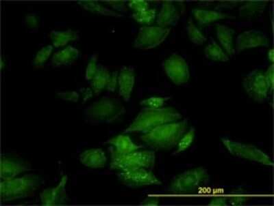 Immunocytochemistry/ Immunofluorescence: RGL2 Antibody (4D10) [H00005863-M02]