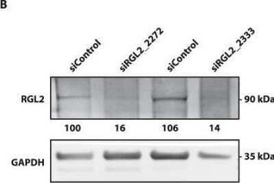 Western Blot: RGL2 Antibody (4D10) [H00005863-M02]