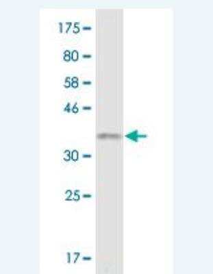 Western Blot: RGL2 Antibody (4F1) [H00005863-M01]