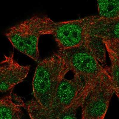 Immunocytochemistry/ Immunofluorescence: RGL2 Antibody [NBP2-68676]