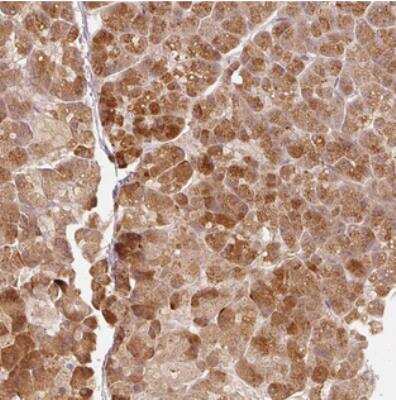 Immunohistochemistry: RGL2 Antibody [NBP2-30581]