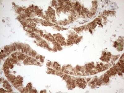 Immunohistochemistry: RGL2 Antibody (OTI10F2) - Azide and BSA Free [NBP2-73875]