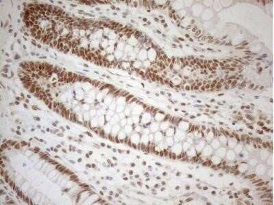 Immunohistochemistry: RGL2 Antibody (OTI10F2) - Azide and BSA Free [NBP2-73875]