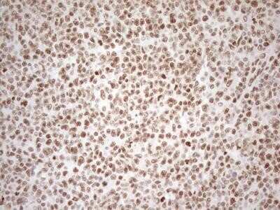 Immunohistochemistry: RGL2 Antibody (OTI10F2) - Azide and BSA Free [NBP2-73875]
