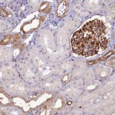 Immunohistochemistry-Paraffin: RGL3 Antibody [NBP1-92326]