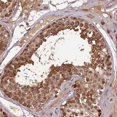 Immunohistochemistry-Paraffin: RGL3 Antibody [NBP1-92327]