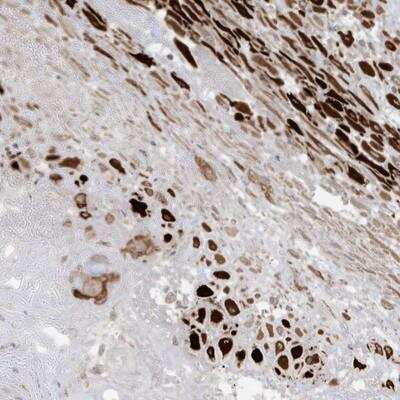 Immunohistochemistry-Paraffin: RGL4 Antibody [NBP1-80840]