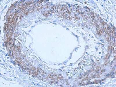 Immunohistochemistry-Paraffin: RGL4 Antibody [NBP2-20145]