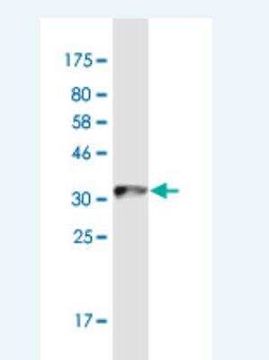 Western Blot: RGM-A Antibody (6D7) [H00056963-M01-100ug]