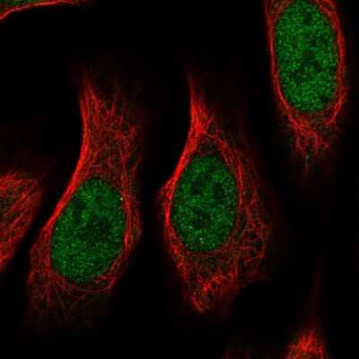 Immunocytochemistry/ Immunofluorescence: RGM-A Antibody [NBP2-58165]