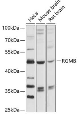 Western Blot: RGM-B AntibodyAzide and BSA Free [NBP2-93453]