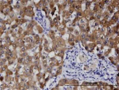 Immunohistochemistry-Paraffin: RGM-C/Hemojuvelin Antibody (1C12) [H00148738-M01]