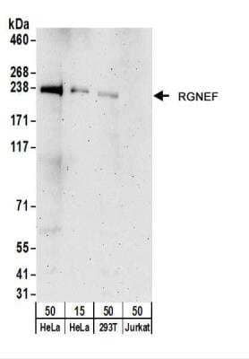 Western Blot: RGNEF Antibody [NBP2-22282]