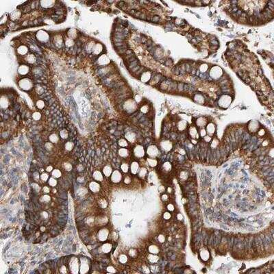 Immunohistochemistry-Paraffin: RGP1 Antibody [NBP1-89621]