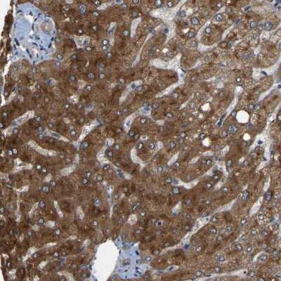 Immunohistochemistry-Paraffin: RGP1 Antibody [NBP1-89622]