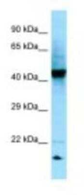 Western Blot: RGP1 Antibody [NBP1-98602]