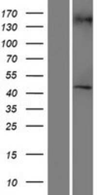 Western Blot: RGP1 Overexpression Lysate [NBP2-08397]