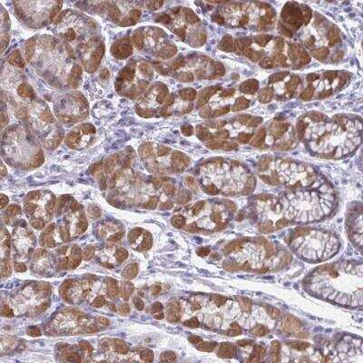 Immunohistochemistry: RGPD1 Antibody [NBP2-46773]