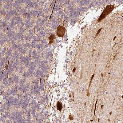 Immunohistochemistry: RGPD5 Antibody [NBP2-46719]