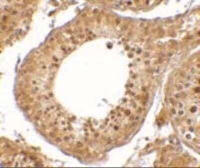 Immunohistochemistry-Paraffin: RGPD5 Antibody - BSA Free [NBP2-41083]