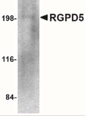 Western Blot: RGPD5 AntibodyBSA Free [NBP2-41083]